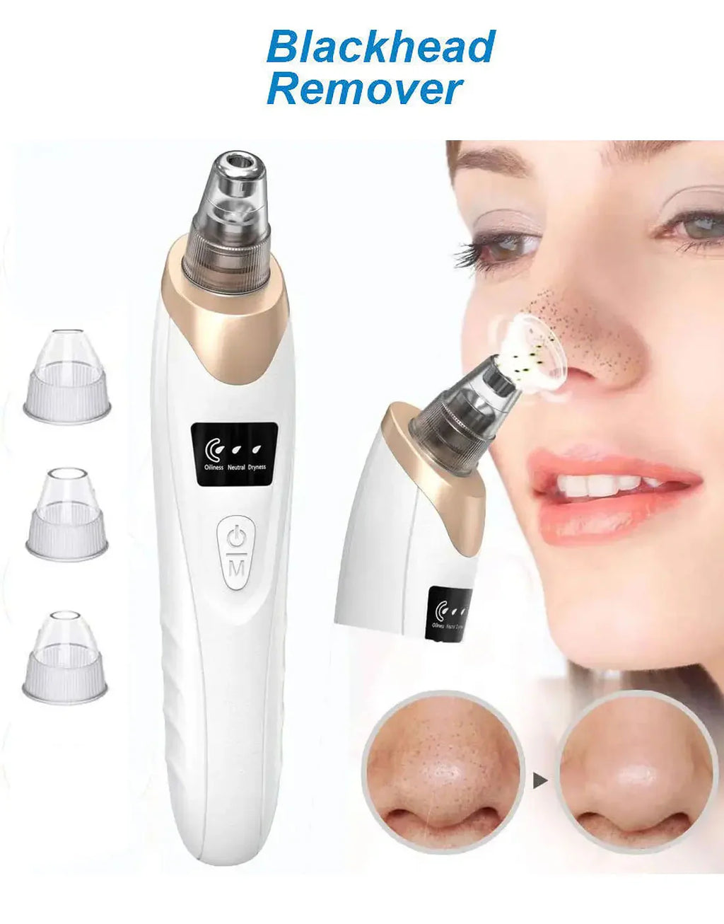 5-in-1 Blackhead Remover Vacuum – Electric Pore Cleaner & Acne Suction Tool for Deep Face Cleaning