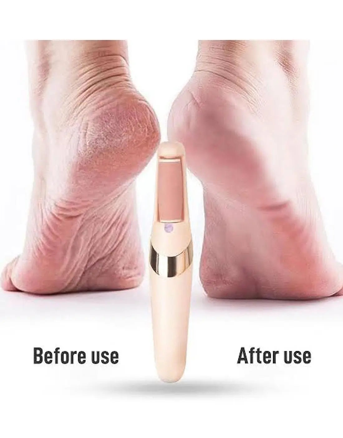 USB Rechargeable Electric Foot Callus Remover – Professional Pedicure Tool for Smooth & Soft Feet
