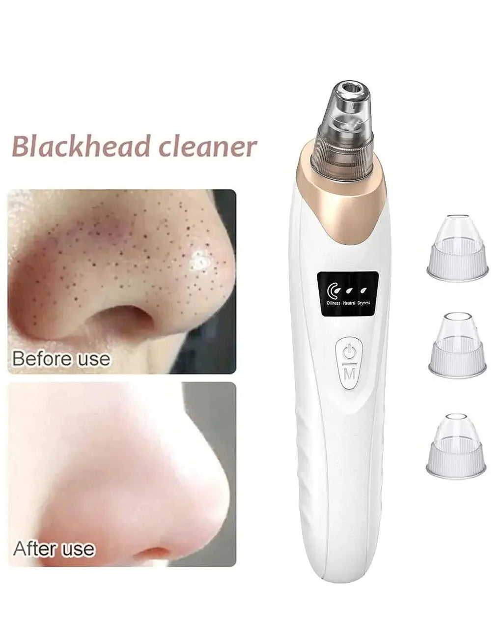 5-in-1 Blackhead Remover Vacuum – Electric Pore Cleaner & Acne Suction Tool for Deep Face Cleaning
