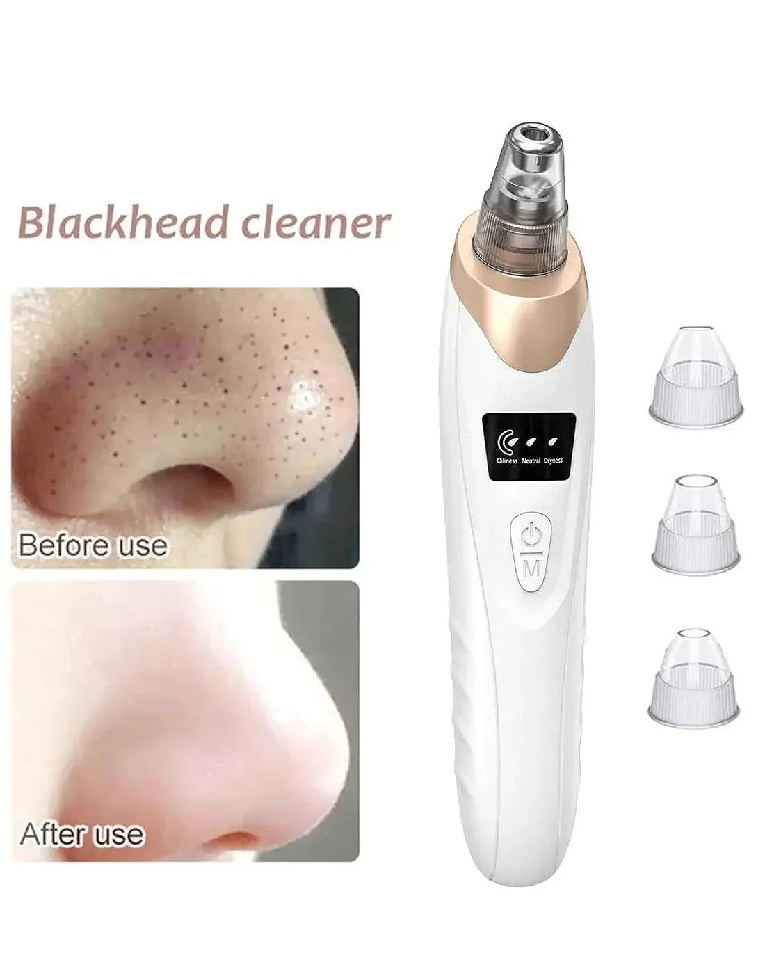 5-in-1 Blackhead Remover Vacuum – Electric Pore Cleaner & Acne Suction Tool for Deep Face Cleaning