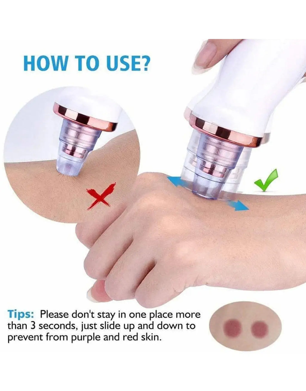 5-in-1 Blackhead Remover Vacuum – Electric Pore Cleaner & Acne Suction Tool for Deep Face Cleaning
